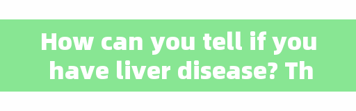 How can you tell if you have liver disease? These 4 methods can be used to confirm the diagnosis