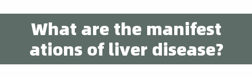 What are the manifestations of liver disease? What are the matters needing attention in life? It's too comprehensive. Collect and forward it.